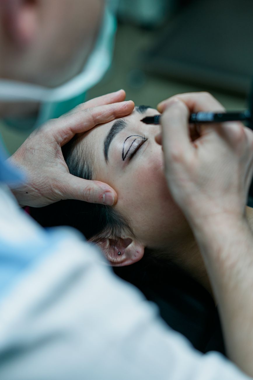 Close-up of a surgeon marking a patient's eyelid for blepharoplasty.